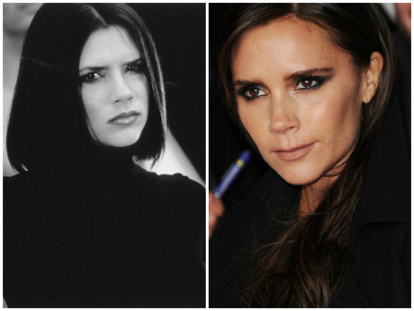 Victoria Beckham já teria feito bichectomia para mudar o contorno da face