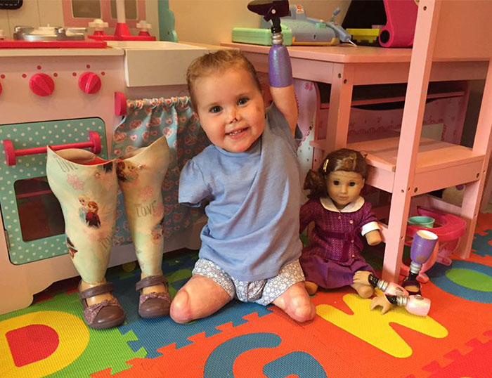A inglesa Harmonie-Rose Ivy Allen, de 2 anos, perdeu os braços e as pernas por causa de uma meningite B aos 11 meses de vida. Recentemente, ela ganhou uma boneca exatamente igual a ela e não podia estar mais feliz com a nova amiga!