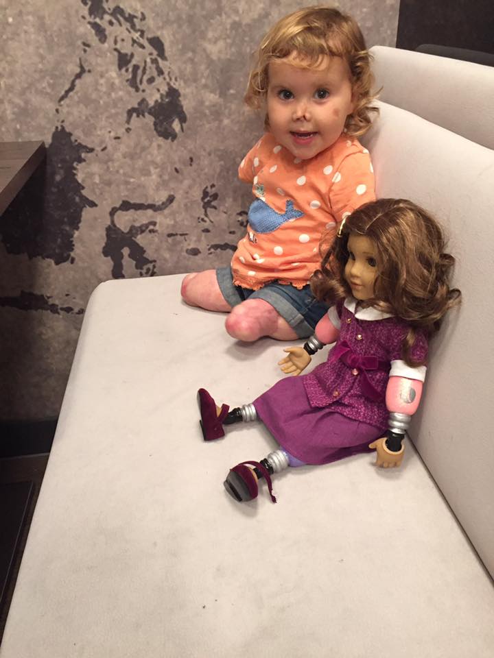A inglesa Harmonie-Rose Ivy Allen, de 2 anos, perdeu os braços e as pernas por causa de uma meningite B aos 11 meses de vida. Recentemente, ela ganhou uma boneca exatamente igual a ela e não podia estar mais feliz com a nova amiga!