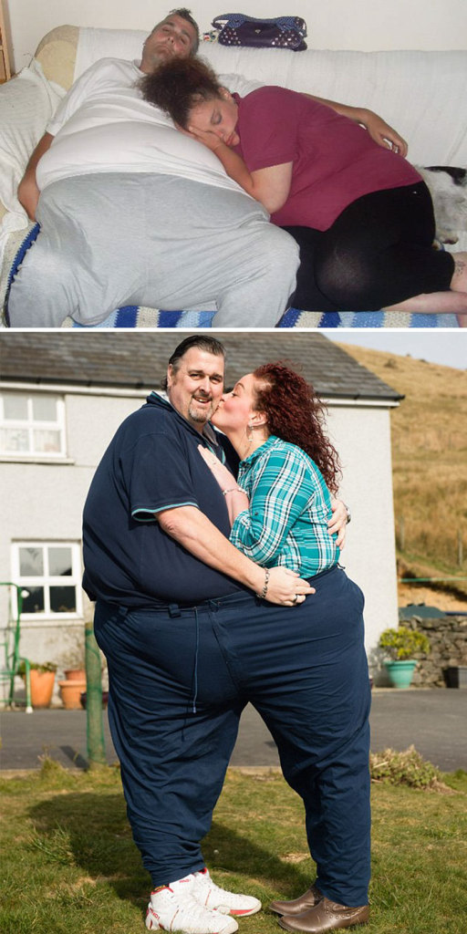 Antes e depois de casais que emagreceram juntos
