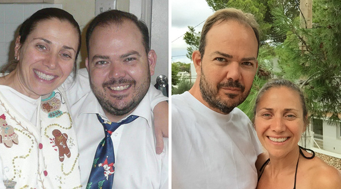 Antes e depois de casais que emagreceram juntos
