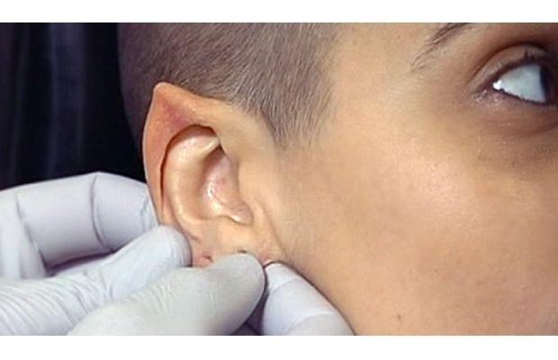 Que tal parecer o Spock? Um elfo ou duende? Bem, a cirurgia que faz as orelhas ficarem pontudas ganhou popularidade em Phoenix, no Arizona, nos Estados Unidos