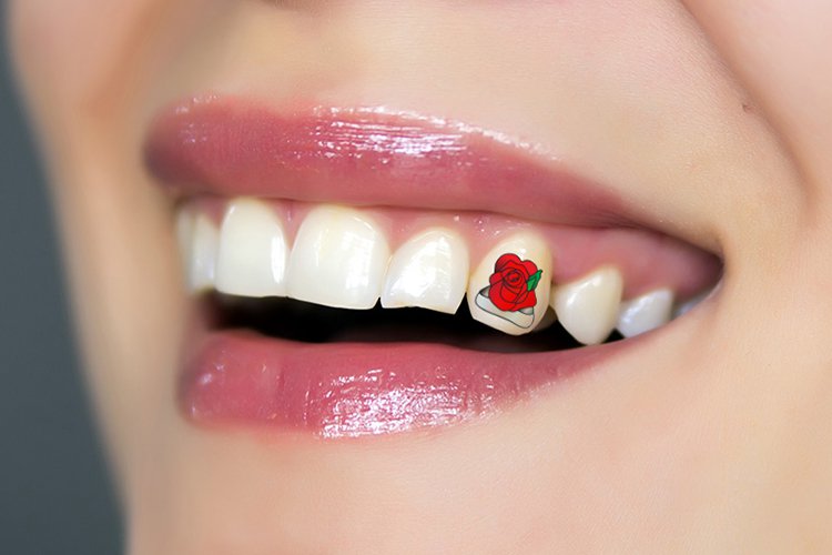 Para quem não quer ter nenhuma tatuagem na pele, uma opção pode ser fazerum desenho no dente! Para fazer, é necessário colocar uma coroa no dente, porque os dentes não conseguem segurar a tinta