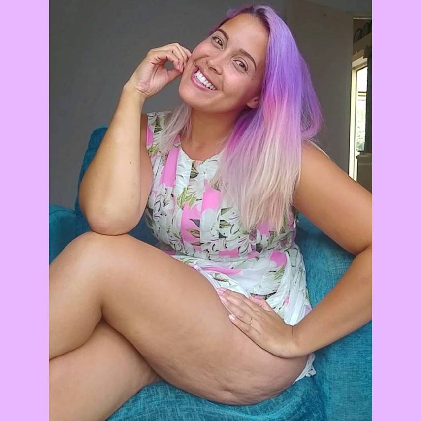 A blogueira inglesa, que superou a anorexia, ajuda outras mulheres a amarem os próprios corpos. Arrasou!