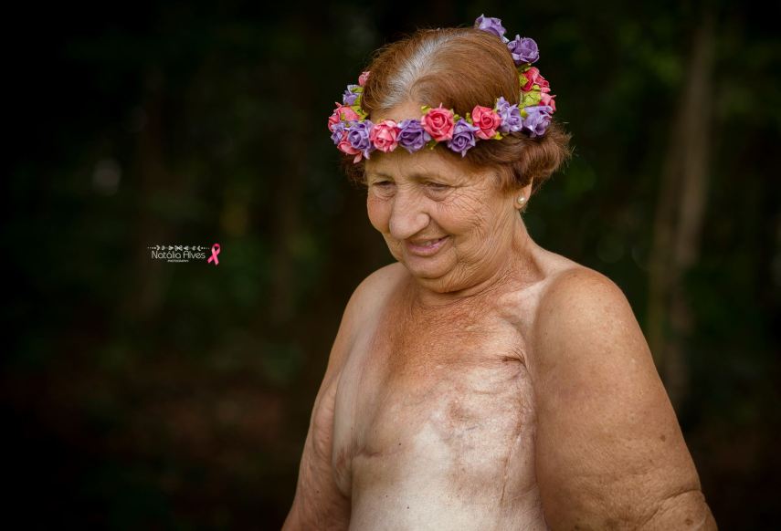 Dona Aurora venceu as sequelas de um erro médico e as cicatrizes de duas mastectomias. Sua neta, a fotógrafa Natália Alves, decidiu homenageá-la com esse álbum especial que ganhou as redes sociais <3