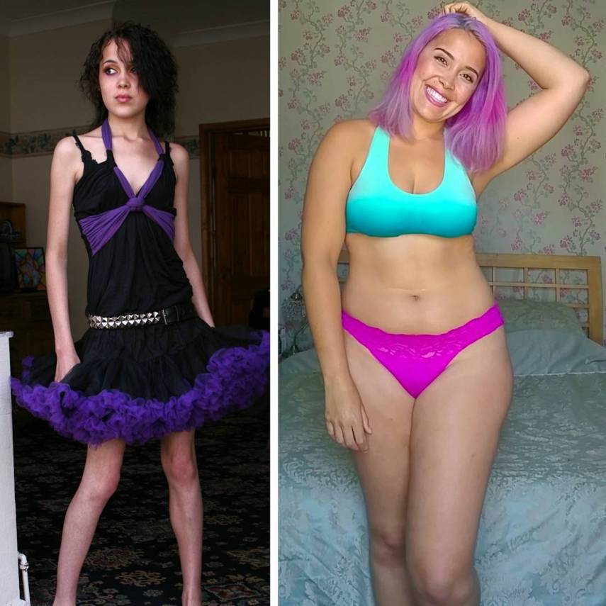 A blogueira inglesa, que superou a anorexia, ajuda outras mulheres a amarem os próprios corpos. Arrasou!