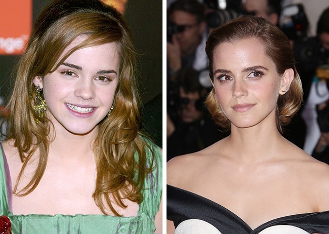 Emma Watson