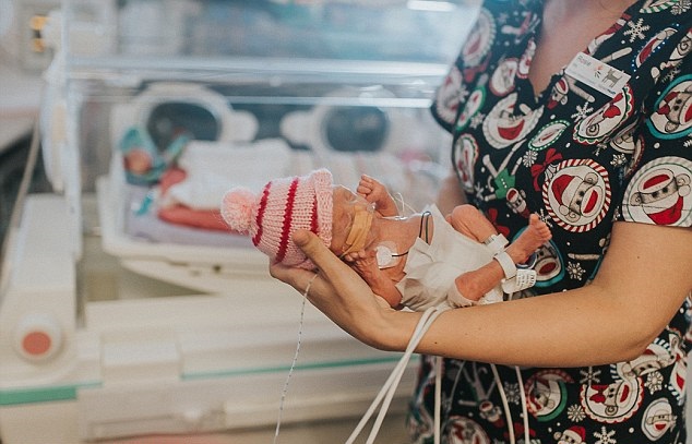 Agnes nasceu no dia 19 de novembro de 2015, quando sua mãe ainda estava na 27ª semana de gestação. Ela pesava 899 gramas e media apenas 34 centímetros. O peso dela chegou a diminuir para 700 gramas durante o processo