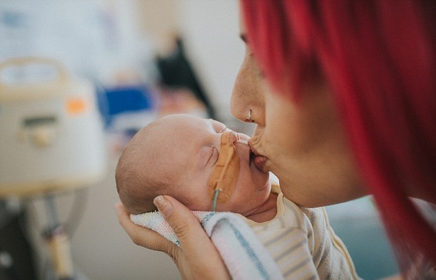 Agnes nasceu no dia 19 de novembro de 2015, quando sua mãe ainda estava na 27ª semana de gestação. Ela pesava 899 gramas e media apenas 34 centímetros. O peso dela chegou a diminuir para 700 gramas durante o processo
