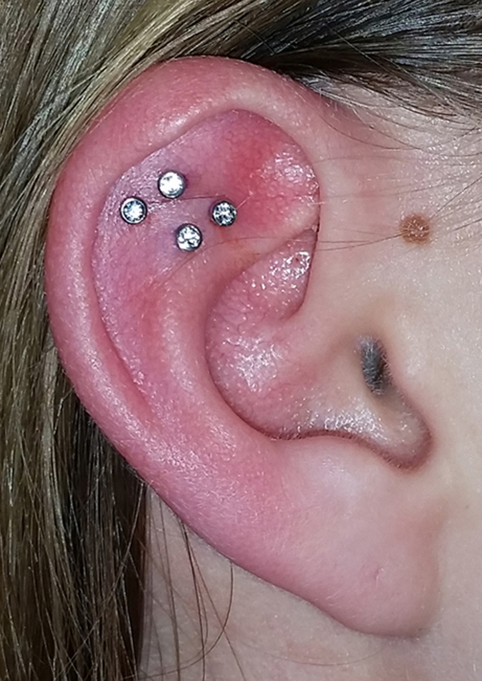 Constelação de piercings vira moda