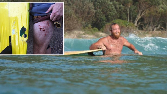 O surfista local Jade Fitzpatrick foi a vítimas mais recente de um ataque de tubarões