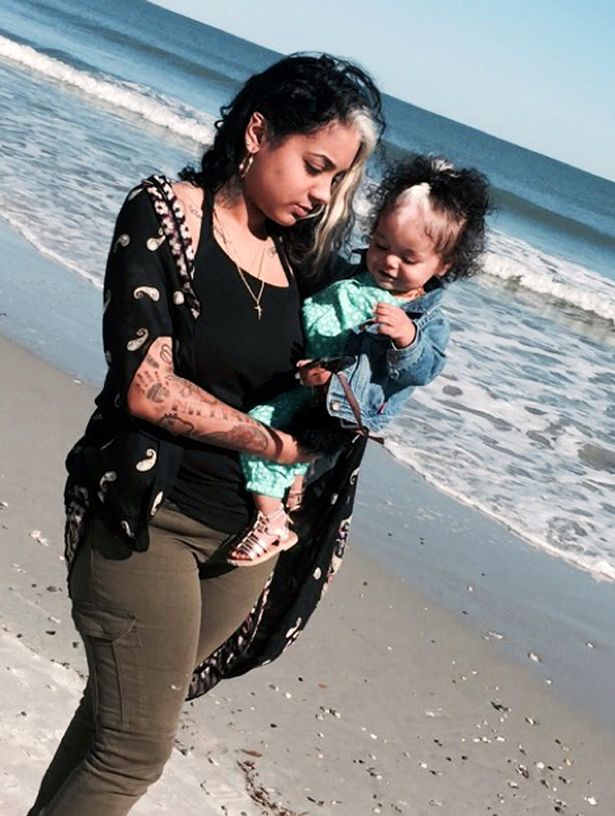 As mulheres da família Worthy carregam a mesma condição genética: poliose. Agora, a bebê MilliAnna é mais uma com a faixa esbranquiçada de cabelos que tanto lembra a Cruella De Vil.