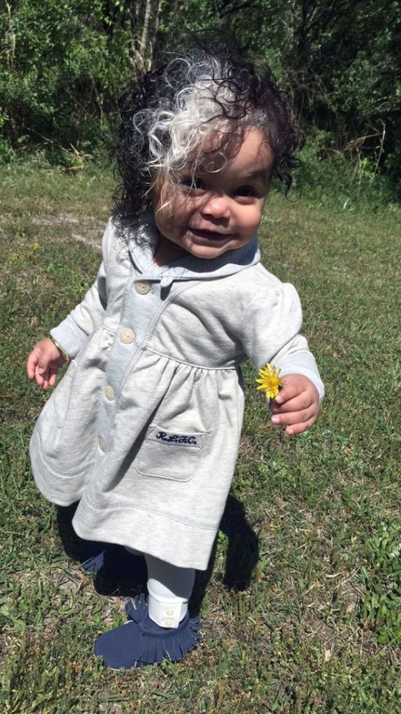 As mulheres da família Worthy carregam a mesma condição genética: poliose. Agora, a bebê MilliAnna é mais uma com a faixa esbranquiçada de cabelos que tanto lembra a Cruella De Vil.