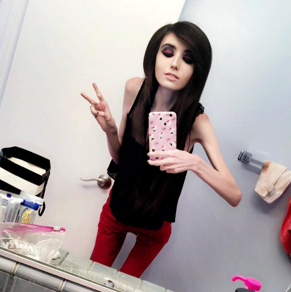 Eugenia Cooney tem mais de um milhão de inscritos no canal de vídeo e quase 500 mil seguidores no Instagram. Mas, nos comentários, só se fala de uma coisa: a magreza excessiva e preocupante da adolescente que pesaria, segundo a imprensa americana, 27 quilos