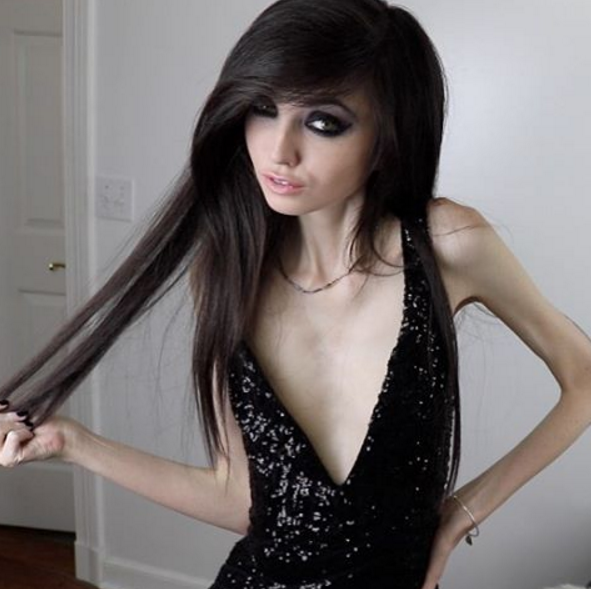 Eugenia Cooney tem mais de um milhão de inscritos no canal de vídeo e quase 500 mil seguidores no Instagram. Mas, nos comentários, só se fala de uma coisa: a magreza excessiva e preocupante da adolescente que pesaria, segundo a imprensa americana, 27 quilos