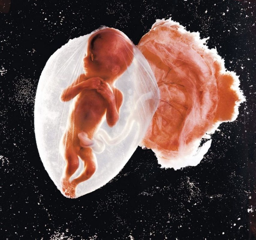 Primeira foto pública de um feto publicada na revista Life, em 1965
