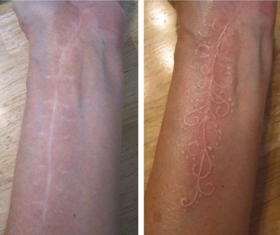 Pessoas transformam traumas em desenhos cheios de beleza e significado