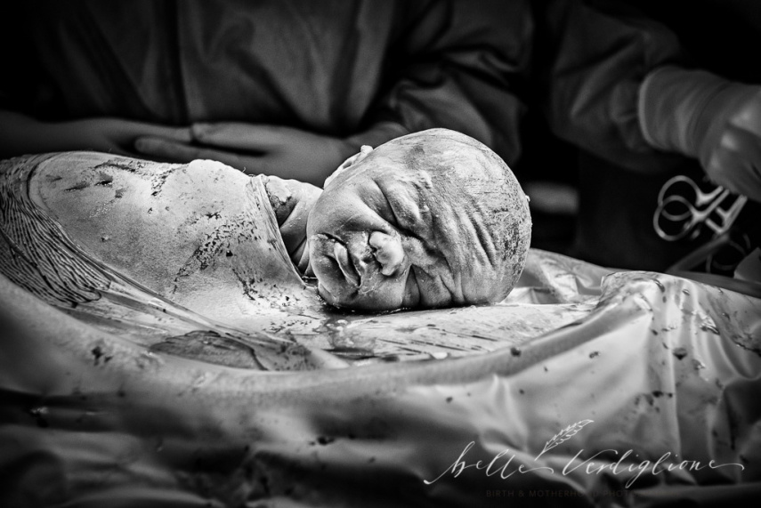 As melhores fotos de parto e pós-parto de 2017