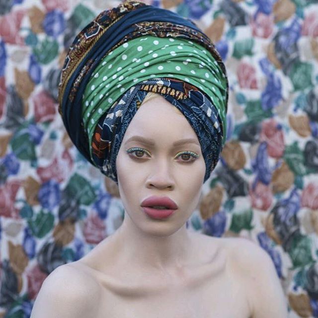 Essa é Diandra Forrest, modelo albina com descendência africana. Apesar do preconceito, Diandra se firmou como uma das maiores apostas do mundo da moda nos últimos anos. Apenas maravilhosa!