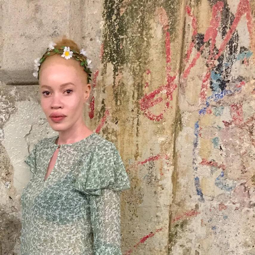 Essa é Diandra Forrest, modelo albina com descendência africana. Apesar do preconceito, Diandra se firmou como uma das maiores apostas do mundo da moda nos últimos anos. Apenas maravilhosa!