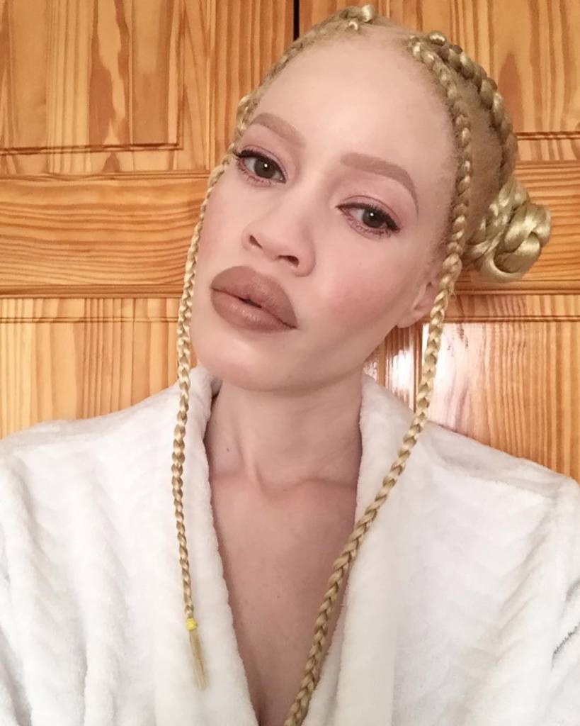 Essa é Diandra Forrest, modelo albina com descendência africana. Apesar do preconceito, Diandra se firmou como uma das maiores apostas do mundo da moda nos últimos anos. Apenas maravilhosa!