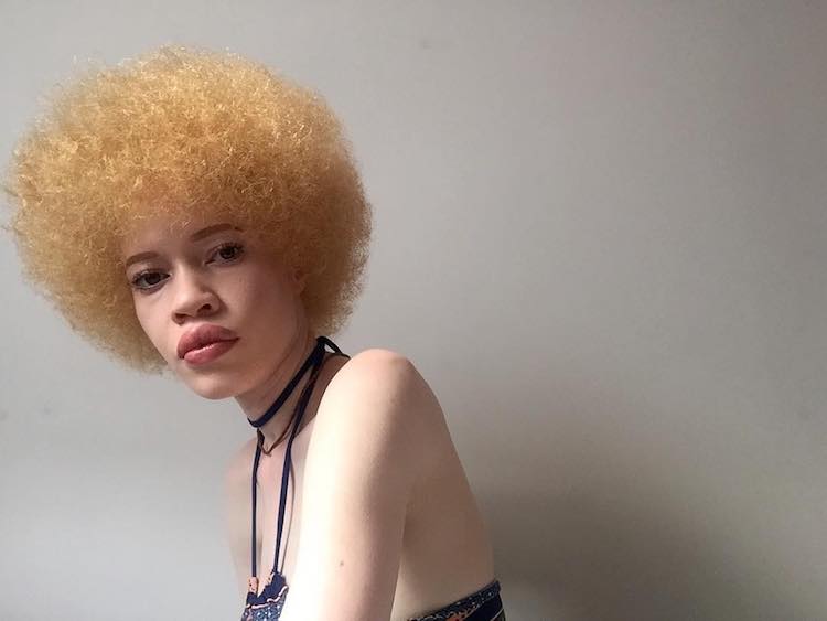 Essa é Diandra Forrest, modelo albina com descendência africana. Apesar do preconceito, Diandra se firmou como uma das maiores apostas do mundo da moda nos últimos anos. Apenas maravilhosa!