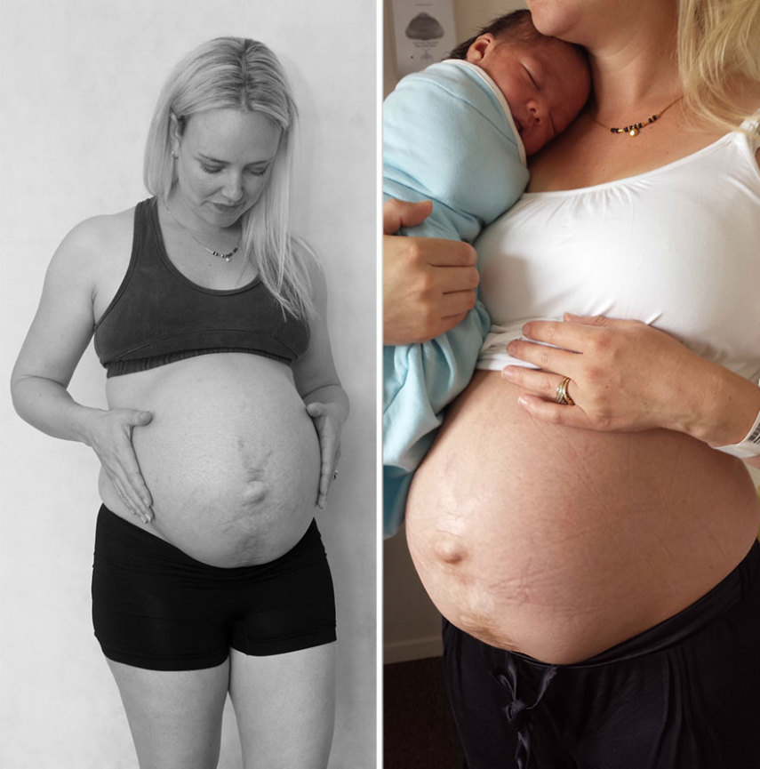 Com 37 semanas, pouco antes de dar à luz, e 24 horas depois do nascimento da criança
