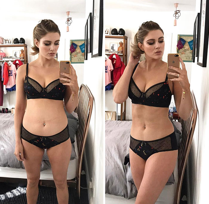 Sabe aquela barriguinha chapada? Blogueiras fitness do Instagram provam que tudo não passa de uma boa postura e um pouco de luz, na medida certa. Um viva às dobrinhas!