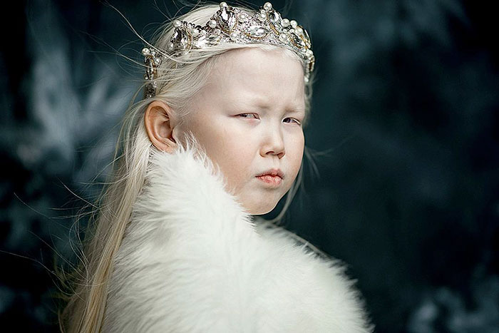 'Branca de Neve siberiana', albina de 8 anos recebe convites para ser modelo