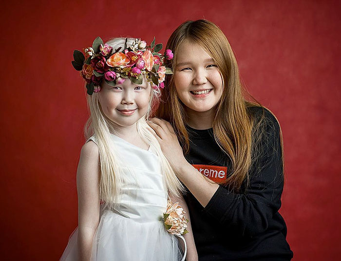 'Branca de Neve siberiana', albina de 8 anos recebe convites para ser modelo