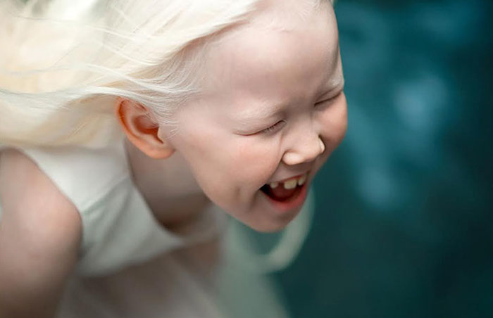 'Branca de Neve siberiana', albina de 8 anos recebe convites para ser modelo