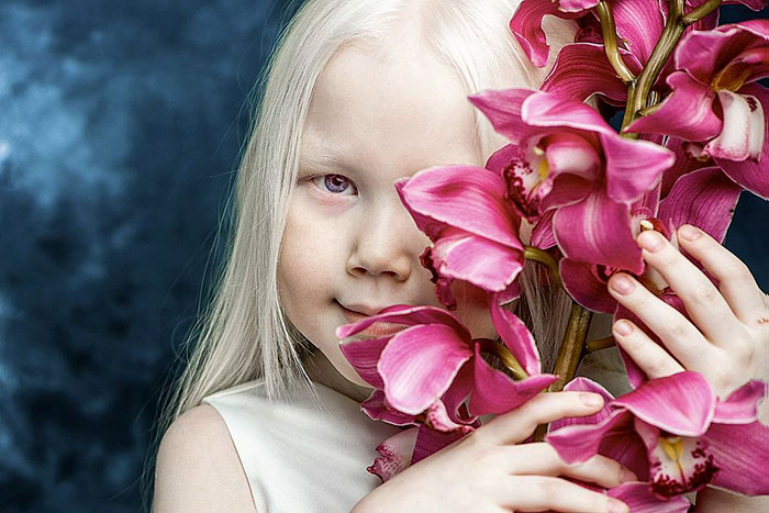 'Branca de Neve siberiana', albina de 8 anos recebe convites para ser modelo