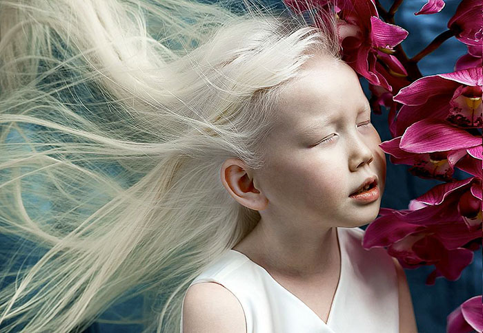'Branca de Neve siberiana', albina de 8 anos recebe convites para ser modelo