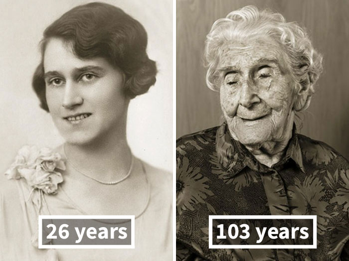 Antes e depois de pessoas que passaram dos 100 anos