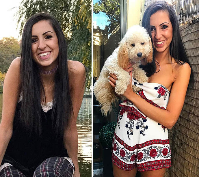 Durante o processo da doença, o peso de Mariah Setta despencou para os 48 kg.