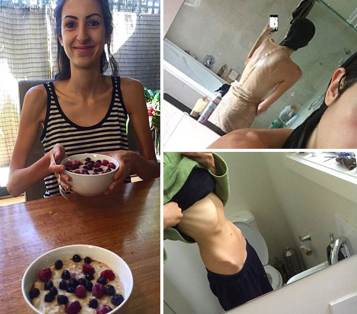 Durante o processo da doença, o peso de Mariah Setta despencou para os 48 kg.