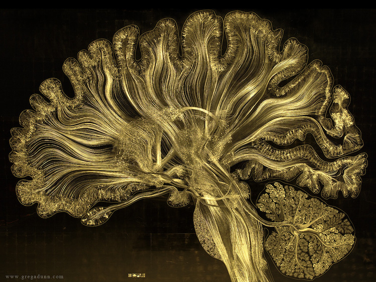 Técnica com folhas de ouro permite visualização espetacular do cérebro