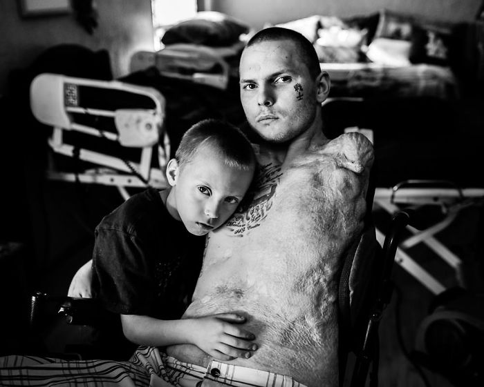 Jerral Hancock estava dirigindo um tanque no Iraque quando uma bomba na estrada atingiu o veículo. Jarral vive em Lancaster com seus dois filhos lindos