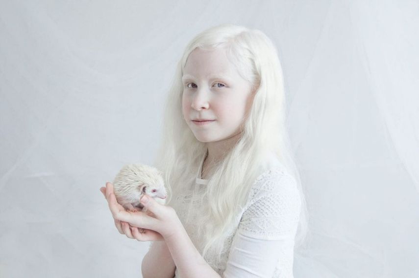 Fotógrafa retrata albinos como anjos