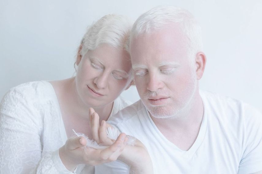 Fotógrafa retrata albinos como anjos