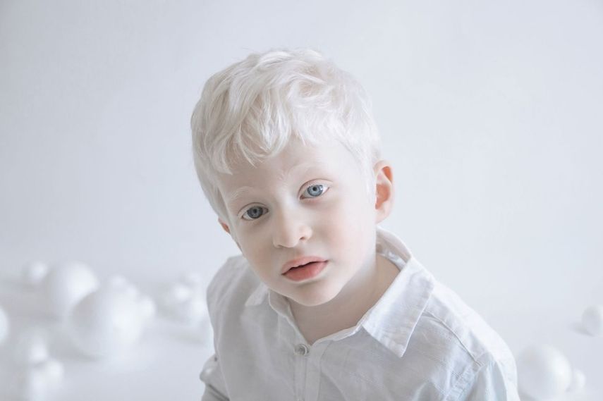 Fotógrafa retrata albinos como anjos