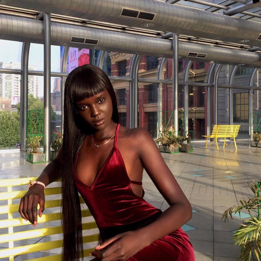 Duckie Thot retomou a carreira depois de enfrentar graves episódios de bullying no 