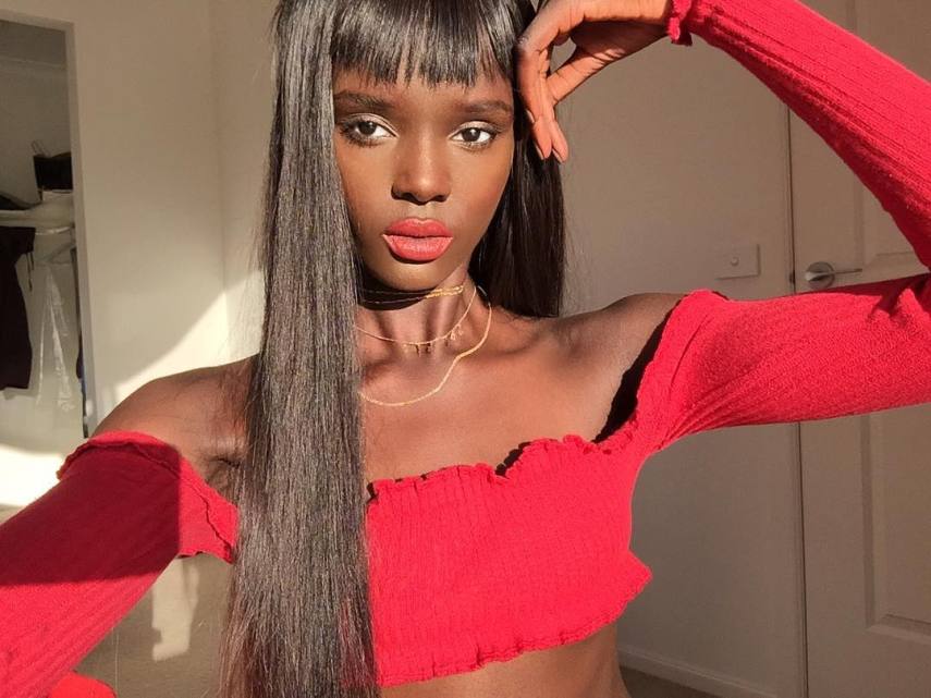 Duckie Thot retomou a carreira depois de enfrentar graves episódios de bullying no 