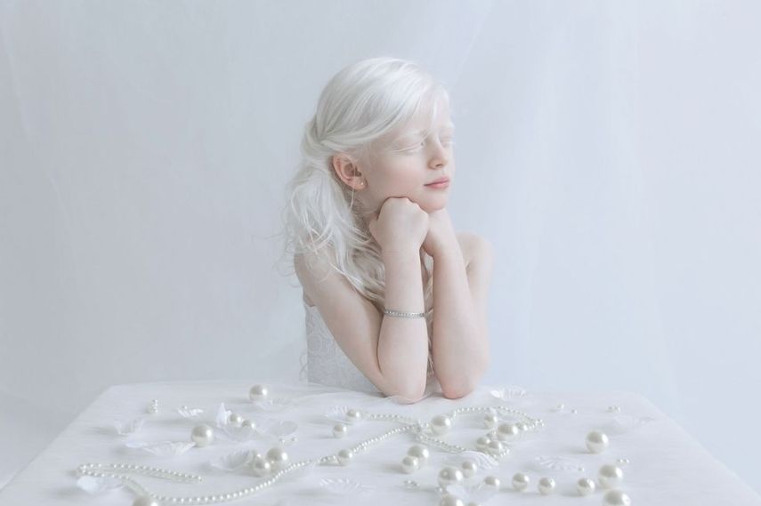 Fotógrafa retrata albinos como anjos