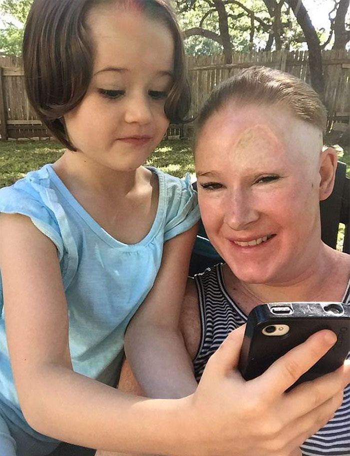 Bethany Gambardella-Greenway, 39 anos, é mãe de duas filhas e está em uma missão de alertar pessoas para a realidade do câncer de pele e tem documentado com uma foto por dia sua batalha contra um melanoma na pele
