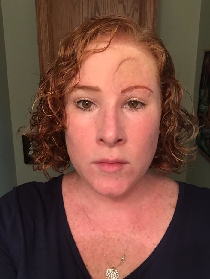 Bethany Gambardella-Greenway, 39 anos, é mãe de duas filhas e está em uma missão de alertar pessoas para a realidade do câncer de pele e tem documentado com uma foto por dia sua batalha contra um melanoma na pele