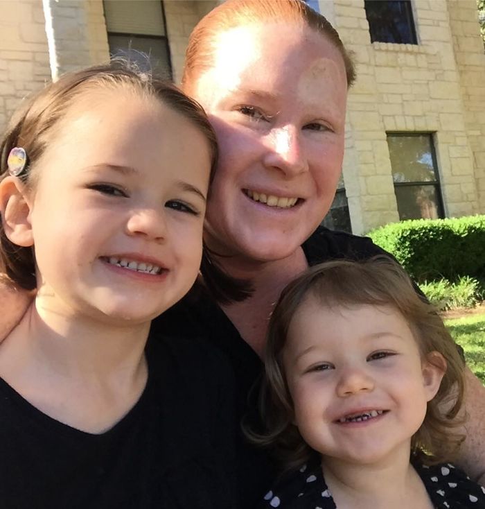Bethany Gambardella-Greenway, 39 anos, é mãe de duas filhas e está em uma missão de alertar pessoas para a realidade do câncer de pele e tem documentado com uma foto por dia sua batalha contra um melanoma na pele
