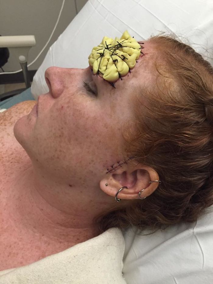 Bethany Gambardella-Greenway, 39 anos, é mãe de duas filhas e está em uma missão de alertar pessoas para a realidade do câncer de pele e tem documentado com uma foto por dia sua batalha contra um melanoma na pele