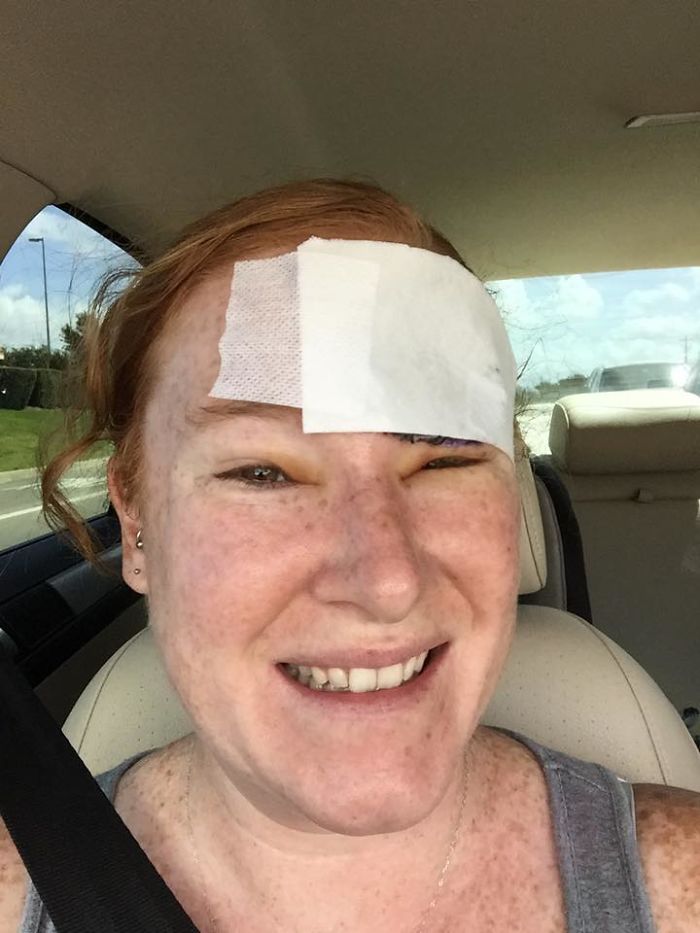 Bethany Gambardella-Greenway, 39 anos, é mãe de duas filhas e está em uma missão de alertar pessoas para a realidade do câncer de pele e tem documentado com uma foto por dia sua batalha contra um melanoma na pele