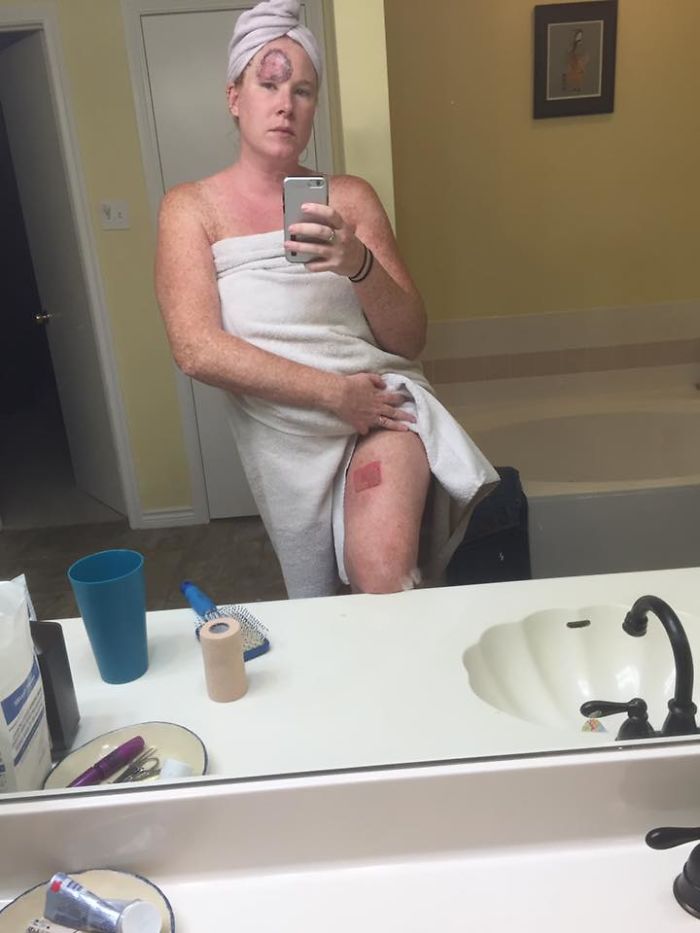 Bethany Gambardella-Greenway, 39 anos, é mãe de duas filhas e está em uma missão de alertar pessoas para a realidade do câncer de pele e tem documentado com uma foto por dia sua batalha contra um melanoma na pele